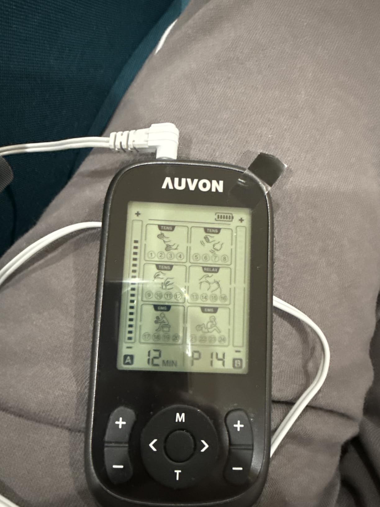 AUVON 3-in-1 TENS Unit Muscle Stimulator, 40 Levels for Gradual Pain Relief | EMS Massage Machine, Drug-Free for Shoulder, Sciatica, Back Pain Relief, 24 Modes Electronic Pulse Massager, 12 TENS Pads customer photo 1