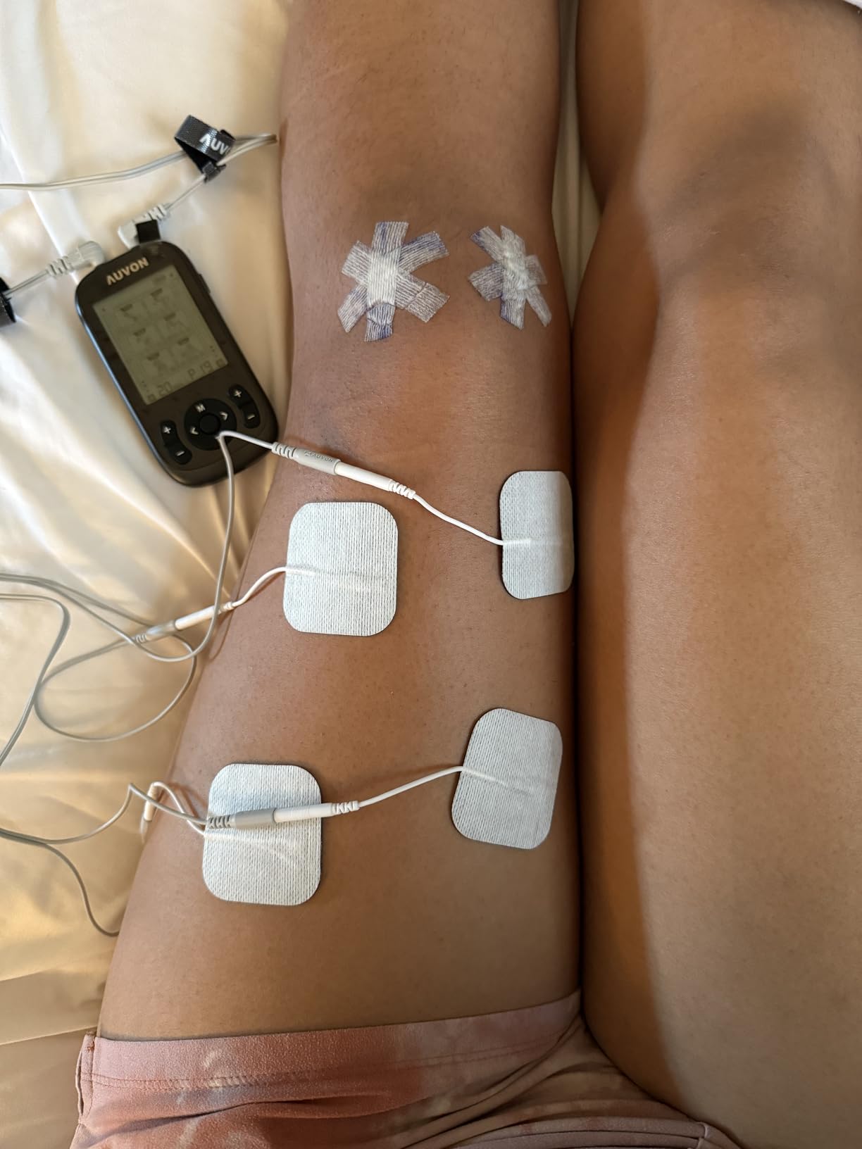 AUVON 3-in-1 TENS Unit Muscle Stimulator, 40 Levels for Gradual Pain Relief | EMS Massage Machine, Drug-Free for Shoulder, Sciatica, Back Pain Relief, 24 Modes Electronic Pulse Massager, 12 TENS Pads customer photo 2