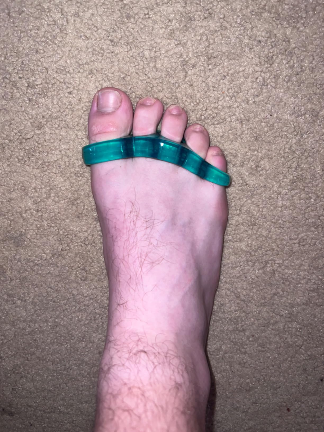 ViveSole Toe Separators for Men & Women Medium (2 Pairs) - Silicone Gel customer photo 1