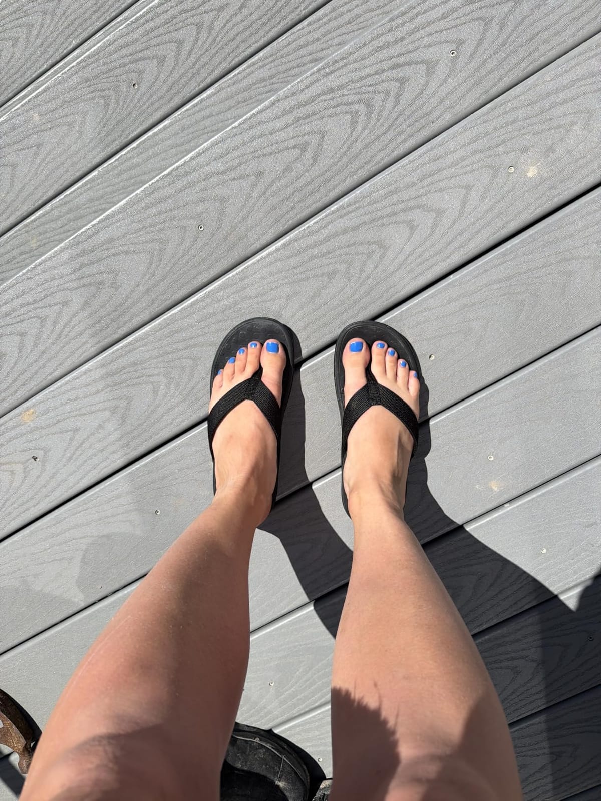 LLSOARSS Plantar Fasciitis Feet Sandal with Arch Support - Best Orthotic flip Flops for Flat Feet,Heel Pain- for Women customer photo 1