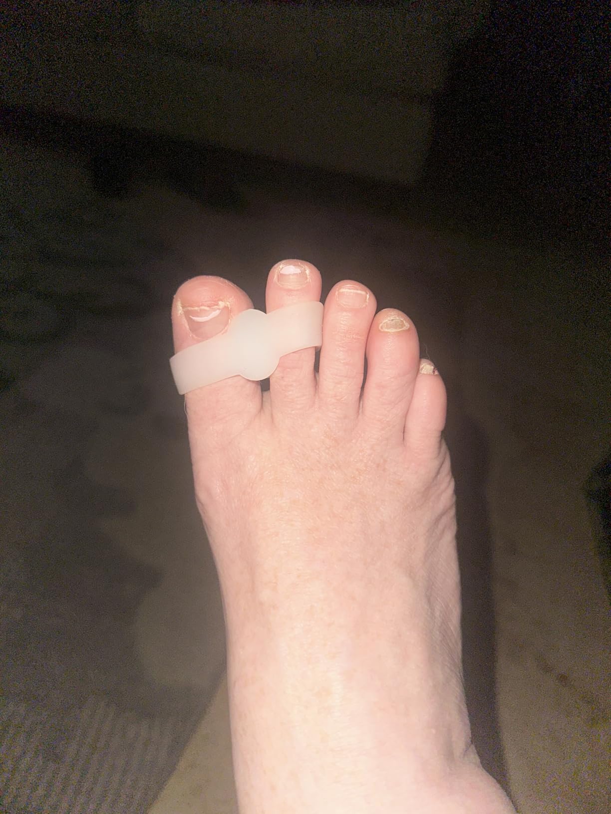 Welnove Pack of 12 Bunion Corrector, Toe Separators with 2 Loops, Big Toe Spacer Suitable for Bunion and Overlap Toe (White) customer photo 1