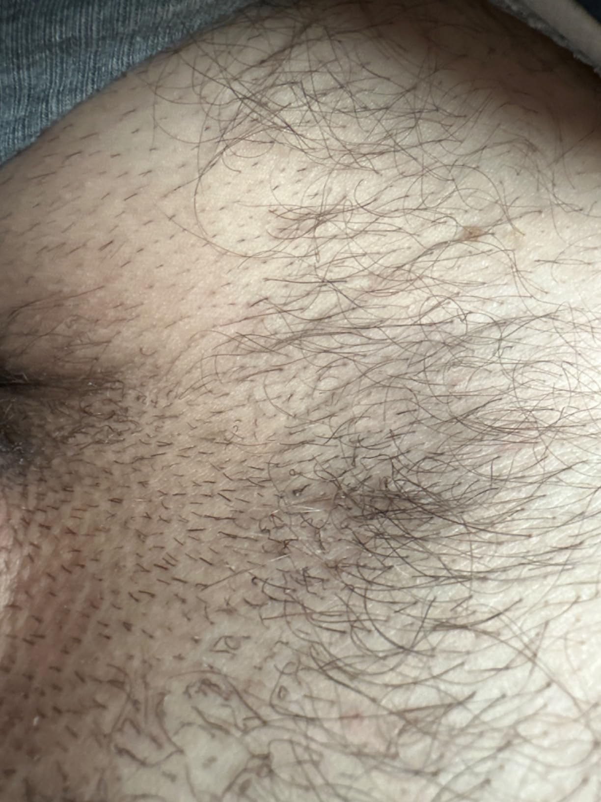 Braun Smart IPL, Skin i Expert Pro 7, VOGUE's Best Hair Removal Device, IPL Hair Removal for Women and Men, Permanent Laser Hair Reduction At-Home, World's 1st Smart App, 3 Heads, IPL7243 customer photo 2
