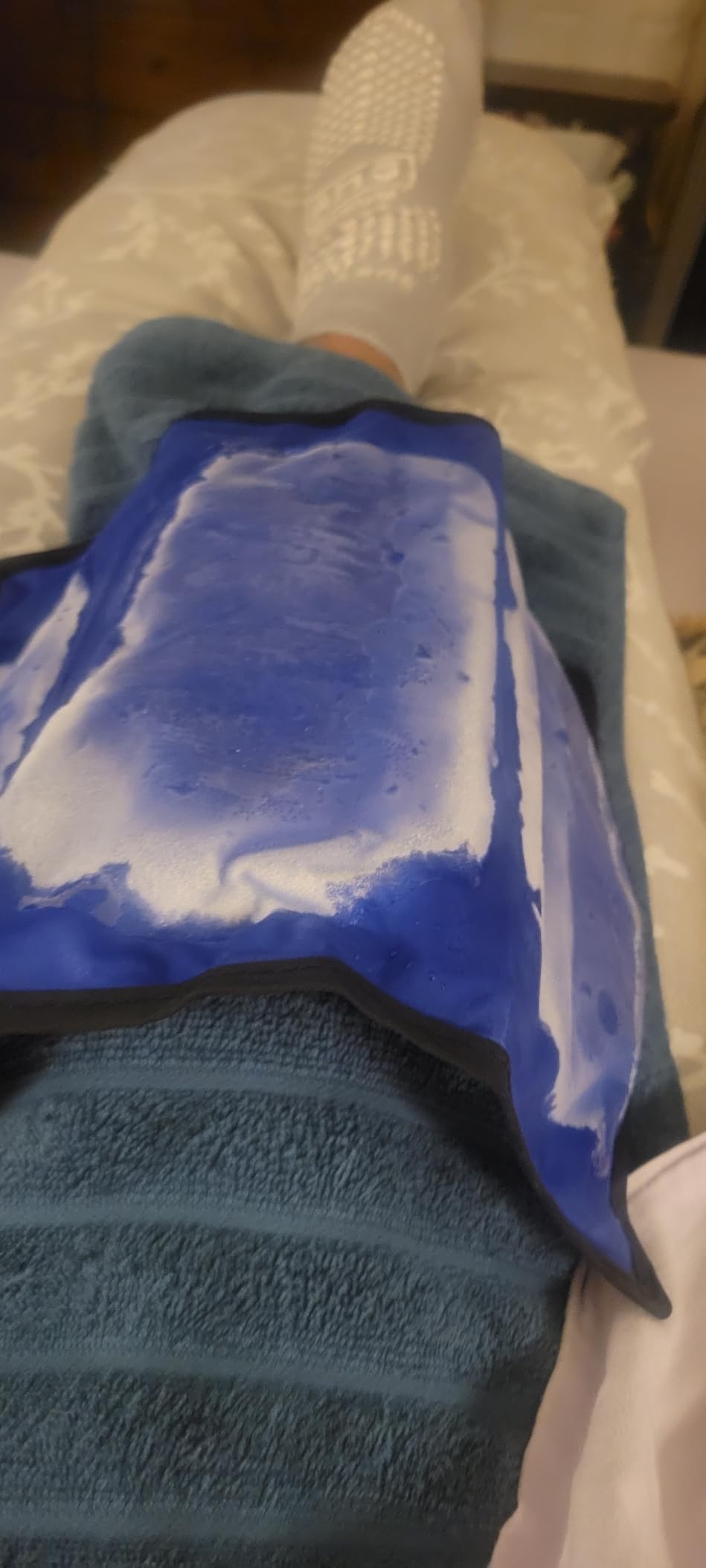 Rester's Choice Reusable Gel Ice Pack for Injuries – Flexible Cold Pack for Pain Relief & Swelling, Stays Cold Longer, Medium 7” x 12”, for Shoulder, Knee, Back (Blue, 1 Pack, 7x12) customer photo 1
