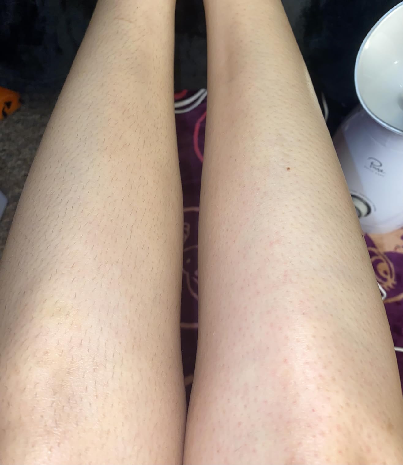 Philips Epilator Series 2000, Corded Epilator for Legs and Body, Hair Removal Device for Women, Model BRE227/00 customer photo 2